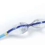 coronary sinus reducer