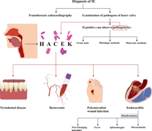 Endocarditis organism